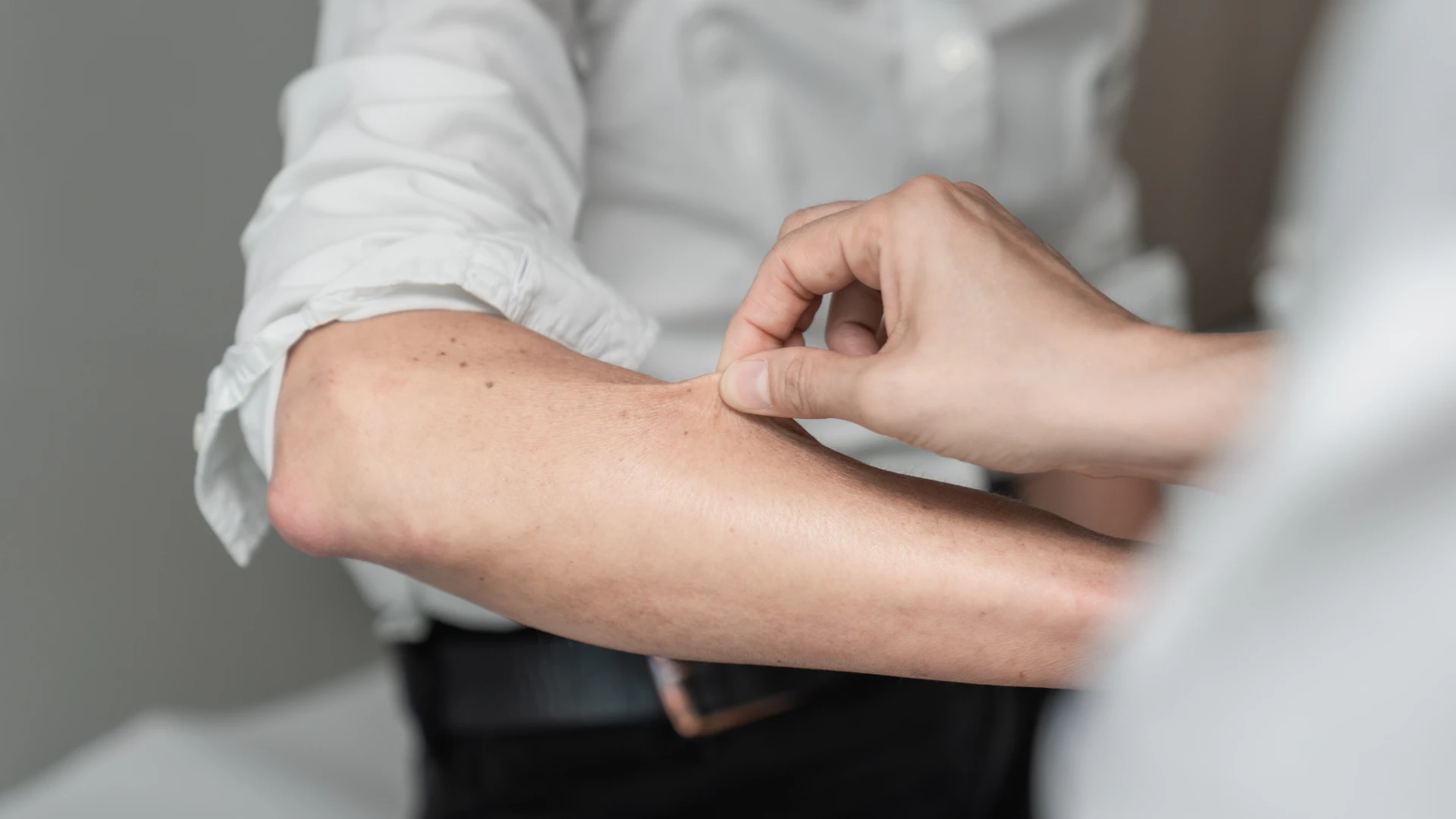Diagnose Ehlers-Danlos-Syndrome (EDS)