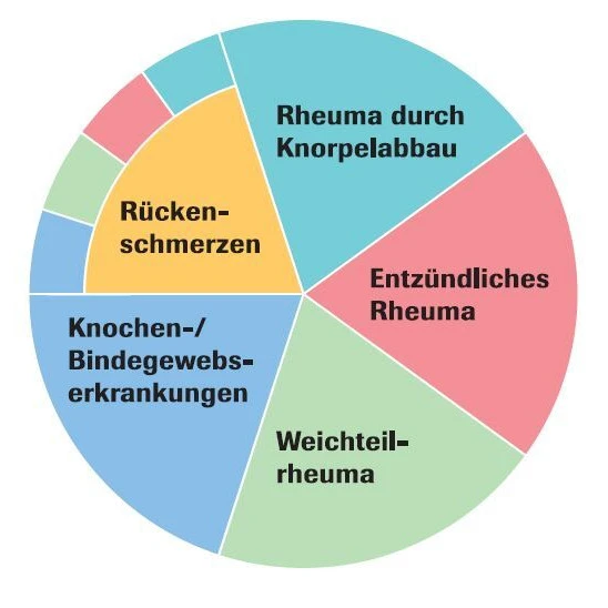 Rheuma kann in fünf verschiedene Formen eingeteilt werden. Rheuma kann in fünf verschiedene Formen eingeteilt werden.