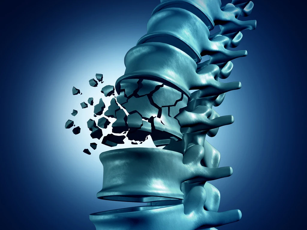 osteoporose