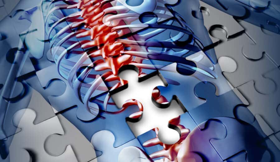 Puzzle Rucken Puzzle Rucken