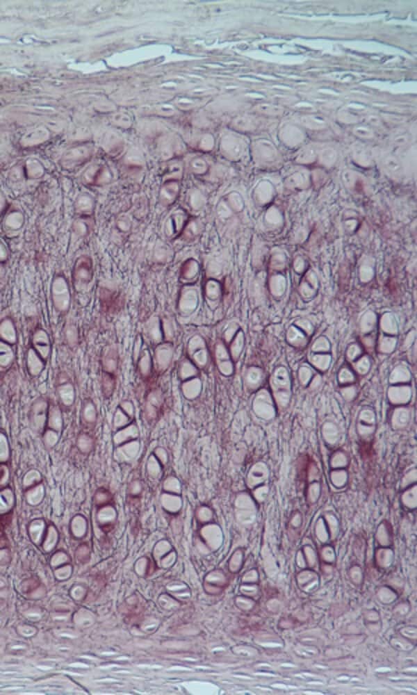 Chondrocytes