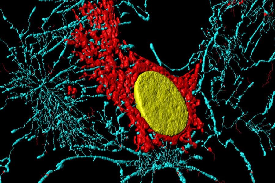 Fibroblastzelle in mikroskopischer Vergrösserung