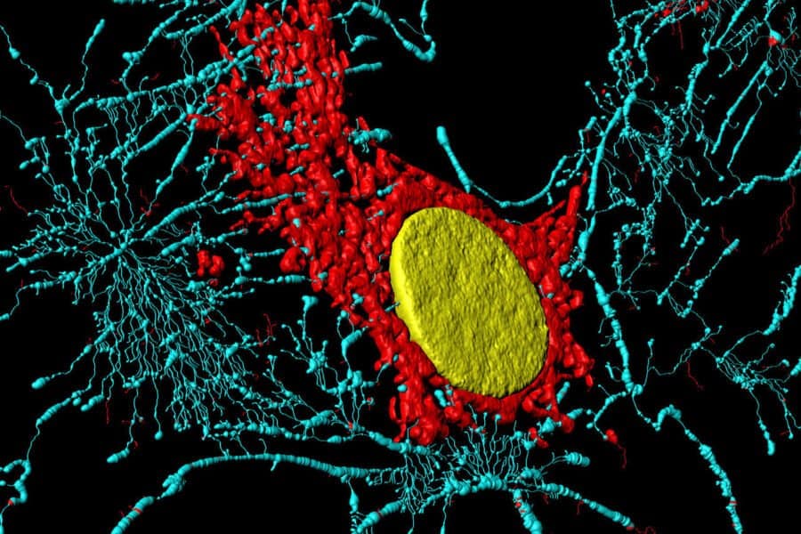 Fibroblast Heiti Paves