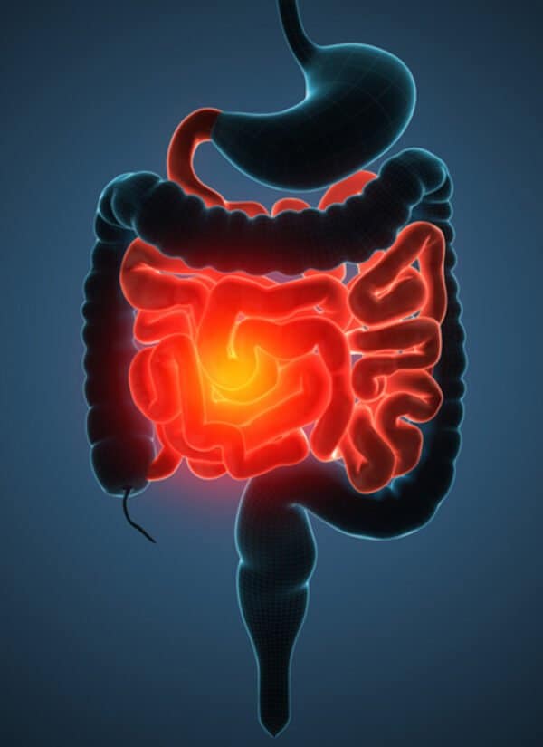 intestino (illustrazione)