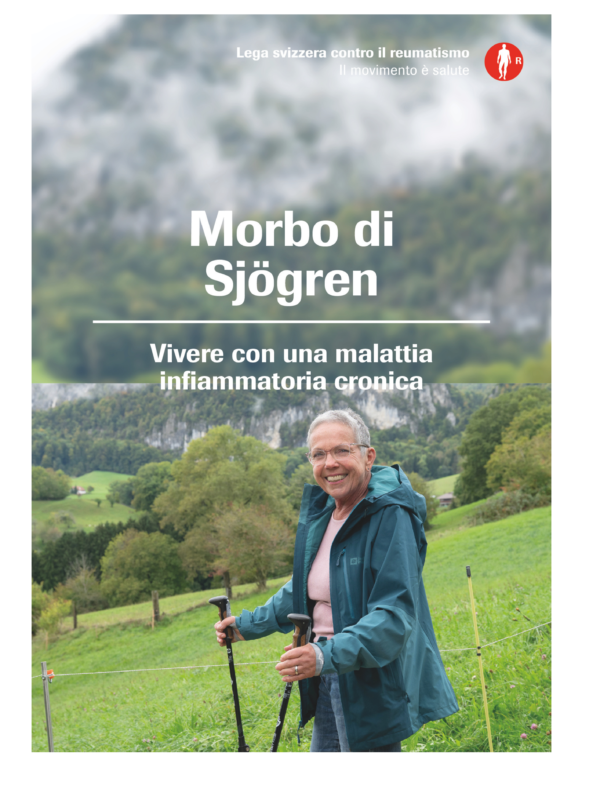 Morbo di Sjögren